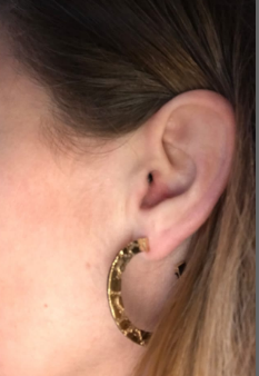 Close-up image showing a person's ear adorned with a large, lightweight gold-plated etched brass hoop earring. The Skin Etched Hoop Earrings by Sara Gunn have a textured, possibly hammered design. The person's hair is light brown and tucked behind the ear.